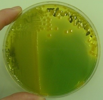vibrio